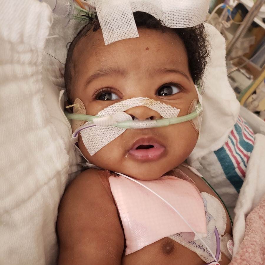 A baby lies in a hospital bed with tubes and medical tape on their face and chest, looking up with wide eyes. The baby has curly hair and is surrounded by medical equipment and blankets.