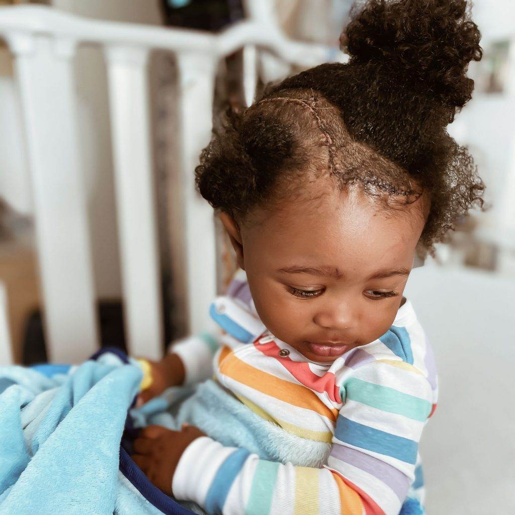 A young child with curly hair and a visible surgical scar on their scalp looks down. The child wears a colorful striped shirt and holds a blue blanket, sitting in a cozy indoor setting.